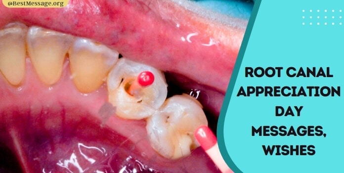 Root Canal Appreciation Day Messages, Wishes,